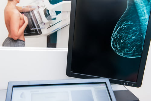Biopsie Marseille et Mammographie à Marseille