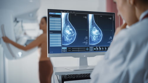 Biopsie Marseille et Mammographie à Marseille
